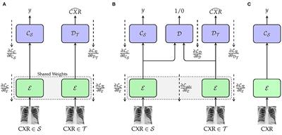 Unsupervised domain adaptation for the detection of cardiomegaly in cross-domain chest X-ray images